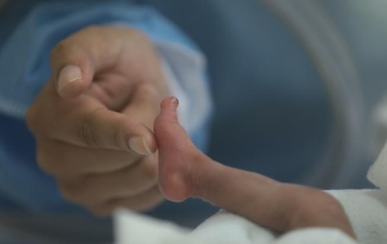 Bebelus-nou-nascut-sursa-Ministerul-Sanatatii-Peru.jpeg - NewsFactor