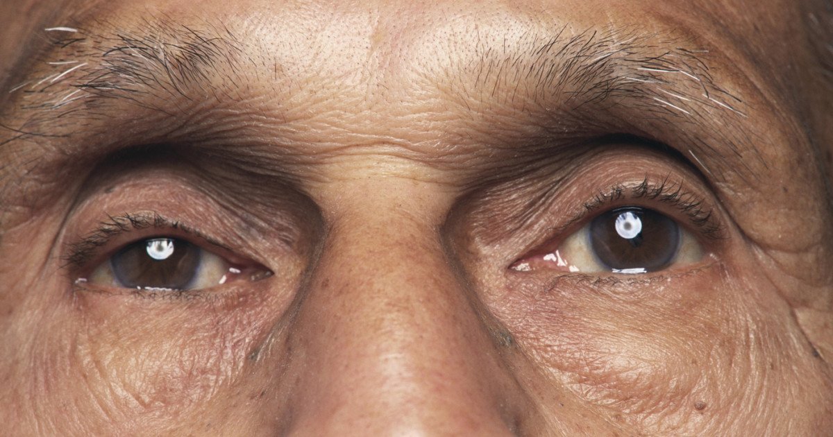 Bacteria din ochi, legată de boala Alzheimer: o descoperire de la Cedars-Sinai Prezența bacteriei Chlamydia pneumoniae în retină a fost asociată cu declinul cognitiv și cu boala Alzheimer, potrivit unui studiu realizat de cercetători de la Cedars-Sinai Medical Center