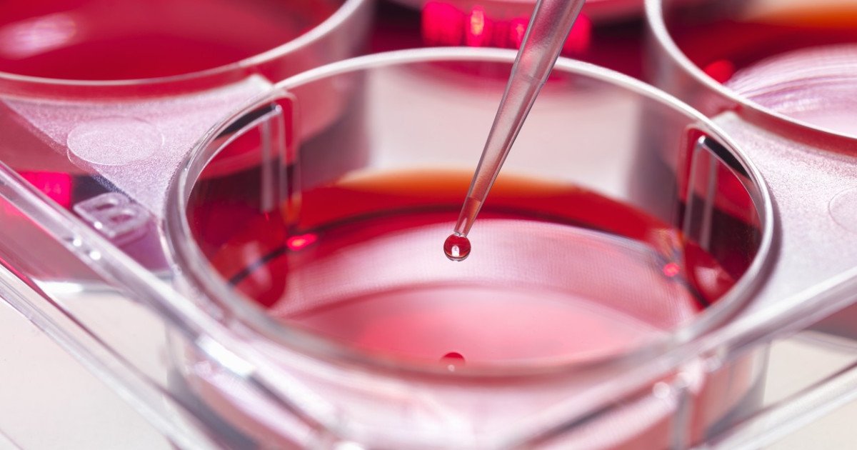 Gata:
Cercetătorii, descoperire: Mecanism ce ar putea bloca leucemia agresivă.