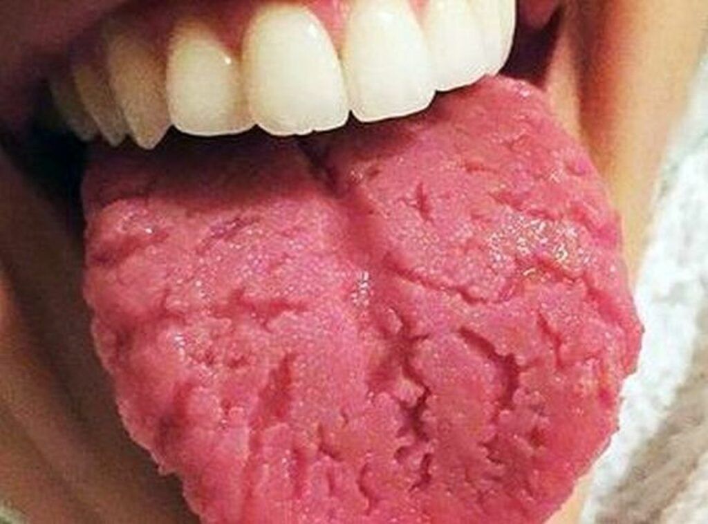 Limba crăpată: Ce semn ignoră oamenii? Află motivul!