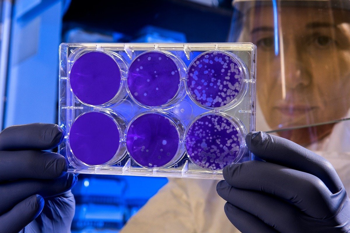 O bacterie din intestinele umane ar putea fi cheia pentru forța musculară sporită O echipă de cercetători a identificat o bacterie intestinală asociată cu o forță musculară mai mare, indicând posibilitatea dezvoltării unui probiotic care să ajute la menținerea masei musculare și a formei fizice odată cu înaintarea în vârstă