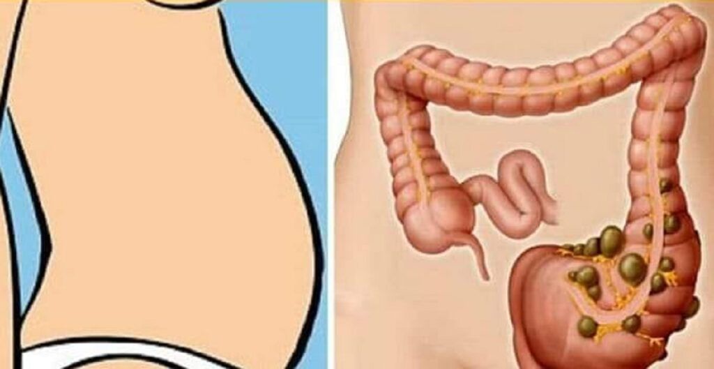 Constipația: Deficitul de vitamine, un inamic ascuns Constipația, o problemă digestivă comună, afectează persoane de toate vârstele, provocând disconfort și balonare