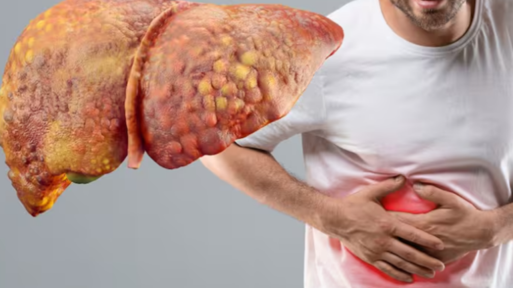 Fructul-minune: Ajută ficatul să elimine grăsimea acumulată