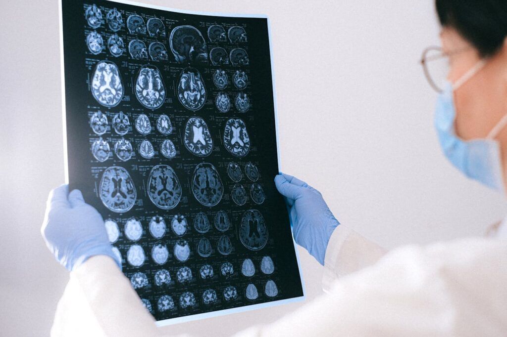 Durerea de cap persistentă, semnul de alarmă al tumorilor cerebrale: Ce spun medicii Deși tumorile cerebrale sunt rare, este esențial să fim conștienți de semnalele pe care corpul ni le transmite