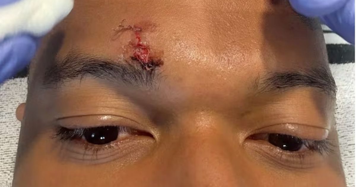 Mbappe, pe mâna medicilor înainte de Bayern – Real: Verdict dur!