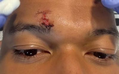 Mbappe, pe mâna medicilor înainte de Bayern – Real: Verdict dur!