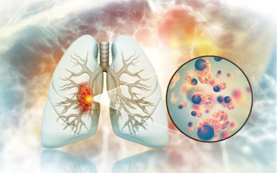 Cancerul pulmonar la nefumători: Legătură ȘOCANTĂ cu legume și fructe