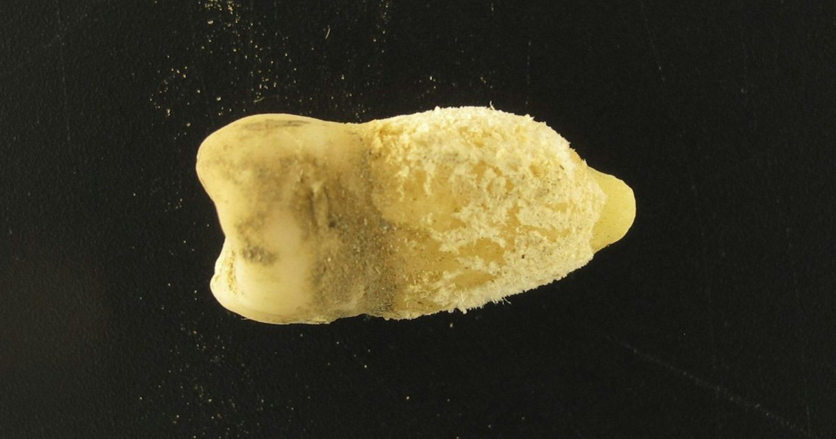 Bacterie de scarlatină, găsită într-o mumie: Misterele Americii Precolumbiene dezvăluite