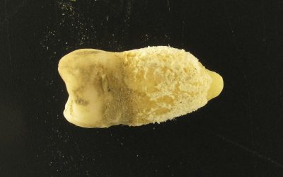 Bacterie de scarlatină, găsită într-o mumie: Misterele Americii Precolumbiene dezvăluite