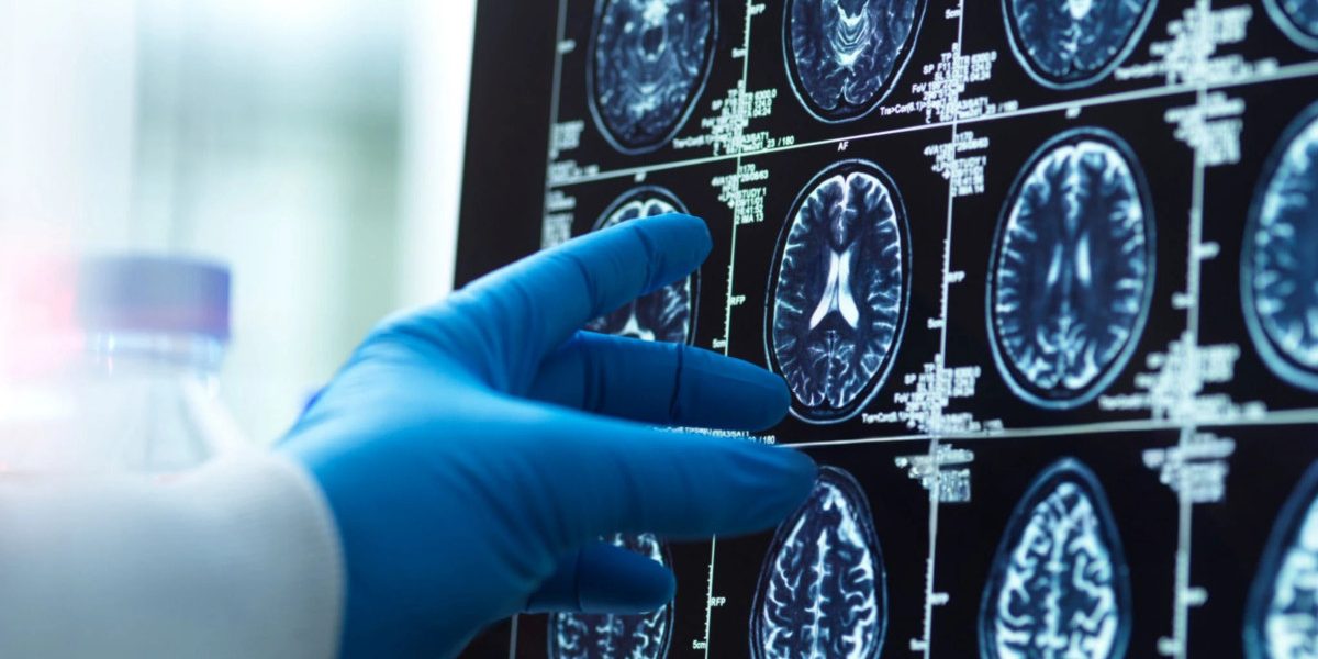 Jmhhc2g9NDI4MGUxMWE1MzZiYmE2M2ZjMTk2NmU5Y2ZiMmQ0NTU.thumb_.jpg - NewsFactor