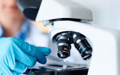 Indiciul-șoc din celule nervoase: Revoluție în tratamentul Parkinson?