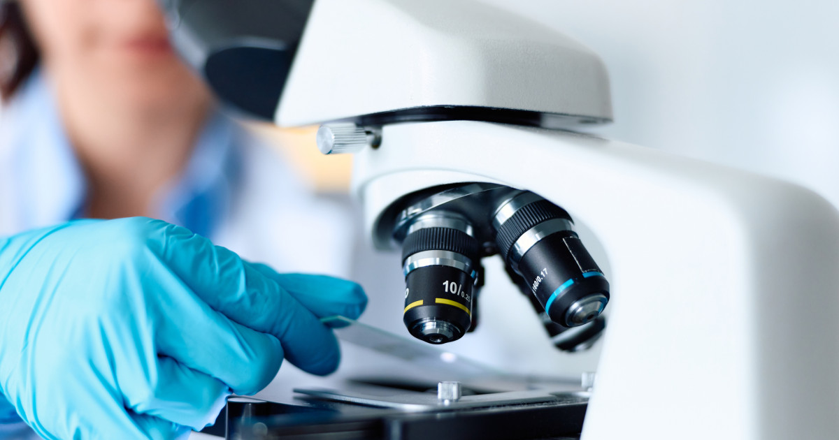 Indiciul-șoc din celule nervoase: Revoluție în tratamentul Parkinson?