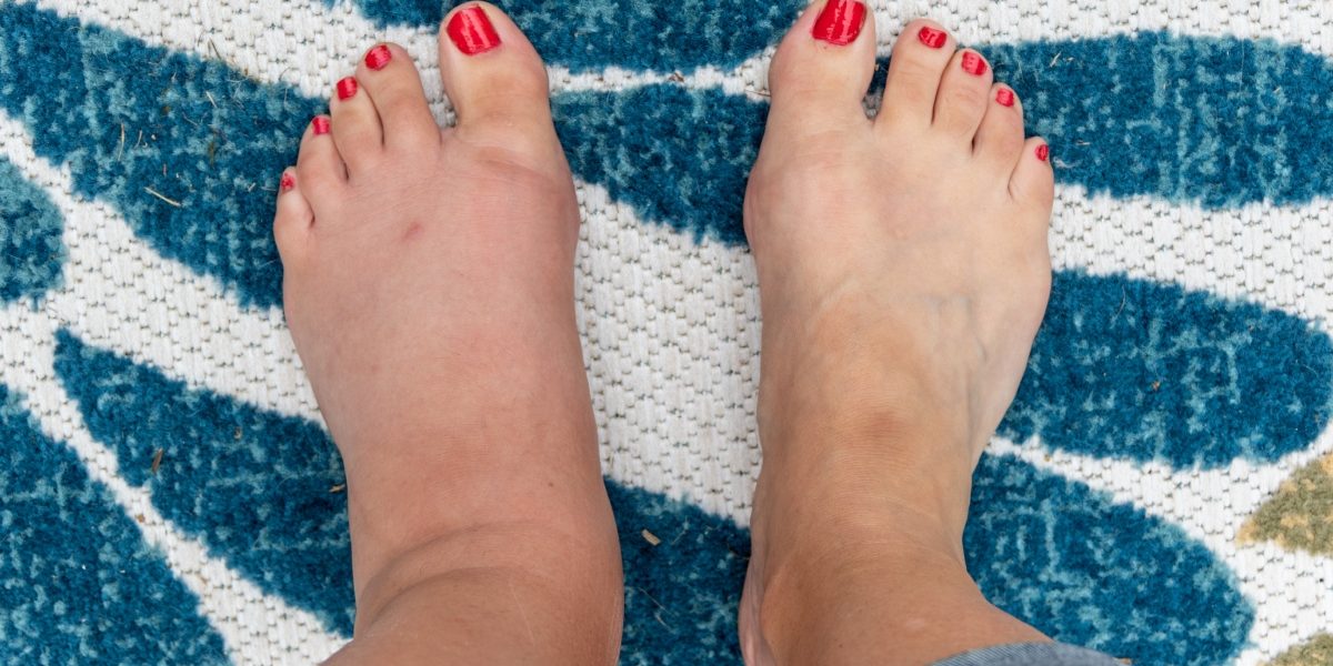 Semnele-ascunse-de-pe-picioare-care-pot-indica-probleme-grave-de-sanatate.-La-ce-trebuie-sa-fii-aten.jpeg - NewsFactor