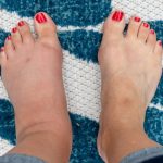Semnele-ascunse-de-pe-picioare-care-pot-indica-probleme-grave-de-sanatate.-La-ce-trebuie-sa-fii-aten.jpeg - NewsFactor