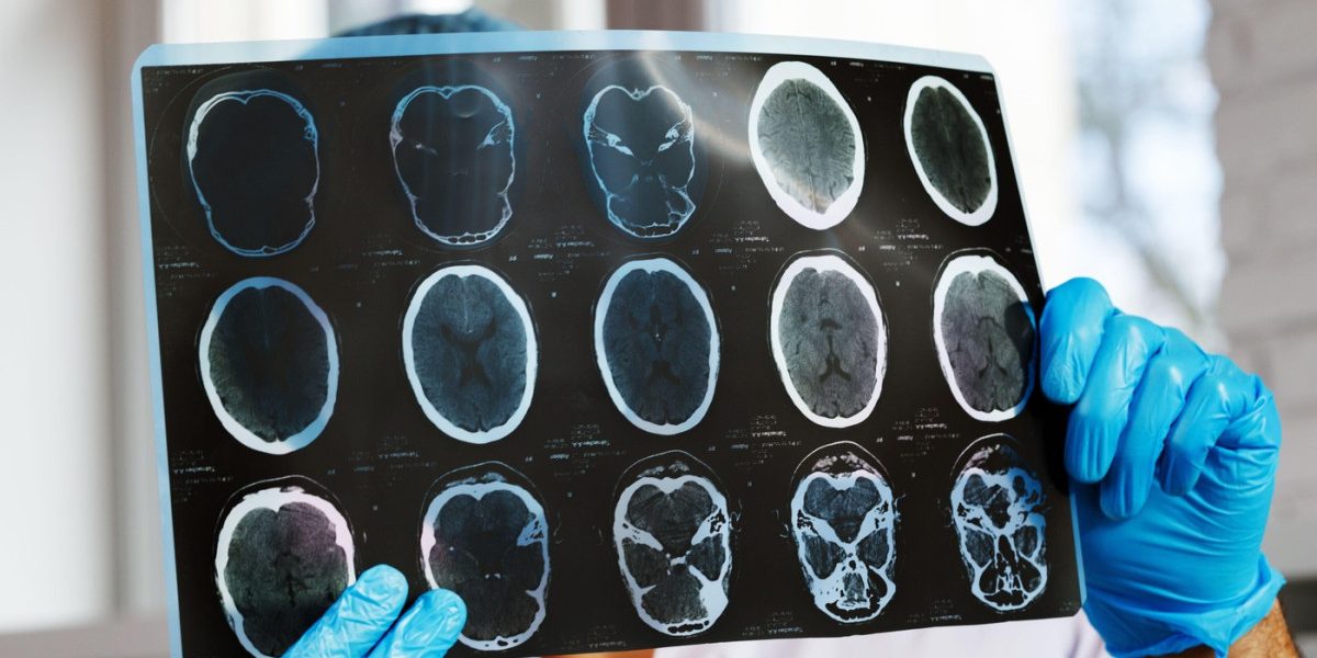 aGFzaD0wMWY1YzUxNWQ0NjdjNjZhMzc4YzgzYmRlODU5MzlhZQ.thumb_.jpg - NewsFactor