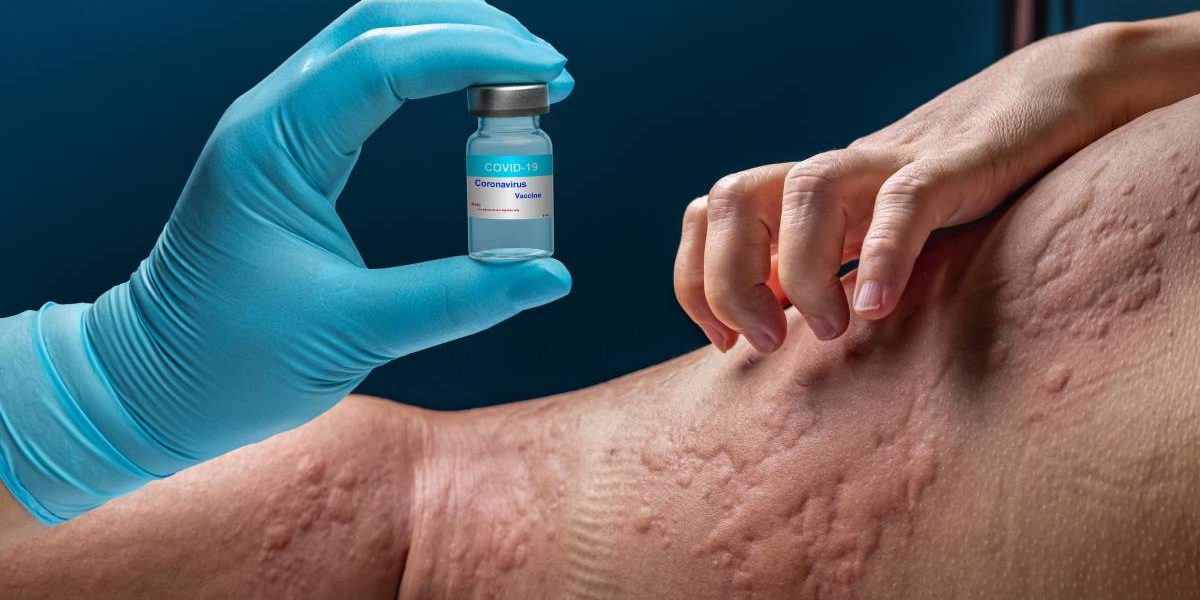 alergii.jpg - NewsFactor