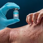 alergii.jpg - NewsFactor