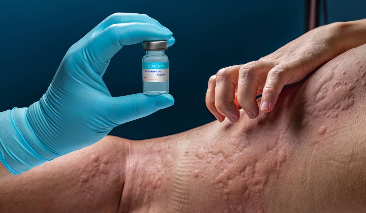 Astm învins: Românul care mănâncă mere după un deceniu