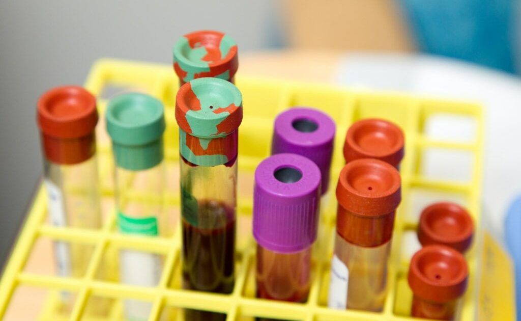 Cât costă analizele în 2026 pentru NEASIGURAȚI: Diferența e URIAȘĂ