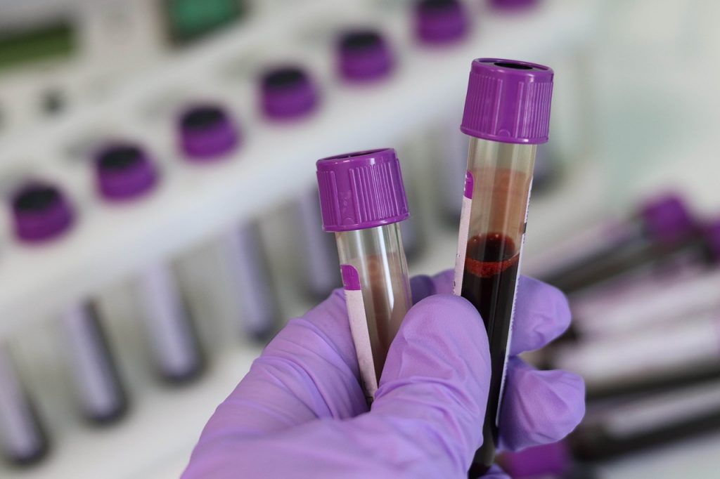 Un test de sânge revoluționar, dezvoltat de cercetătorii de la Universitatea din California, Los Angeles (UCLA), ar putea detecta, în viitor, mai multe tipuri de cancer și alte afecțiuni simultan