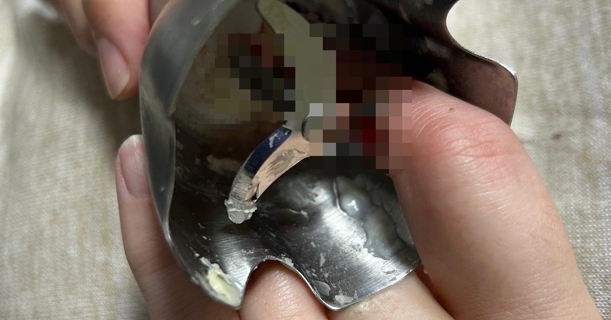 Două femei din Iași, victime ale unor accidente casnice grave