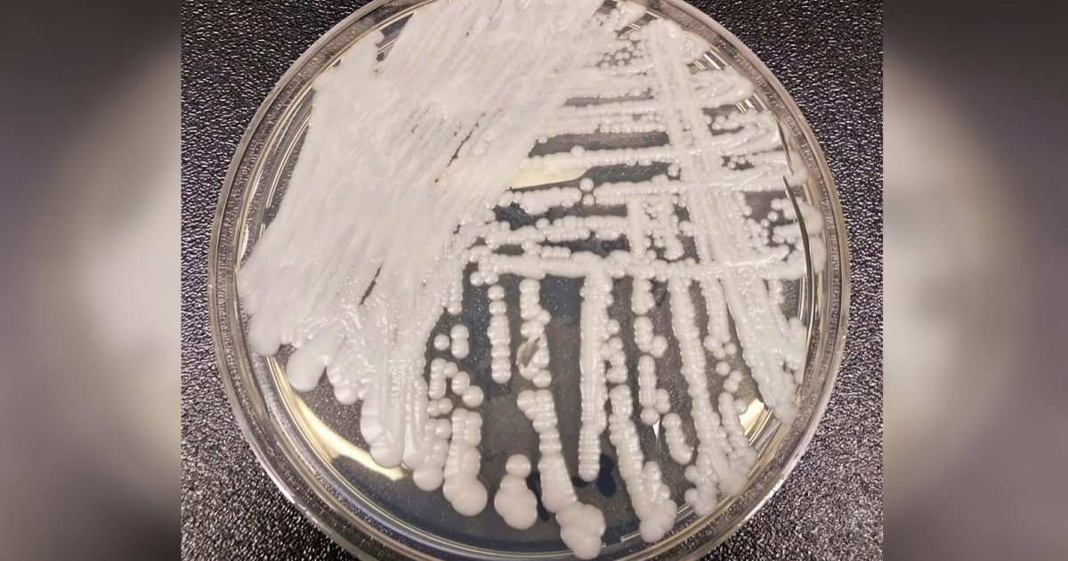 C. Auris, ciuperca-ucigașă, face ravagii în România: Cum o oprim