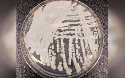 C. Auris, ciuperca-ucigașă, face ravagii în România: Cum o oprim