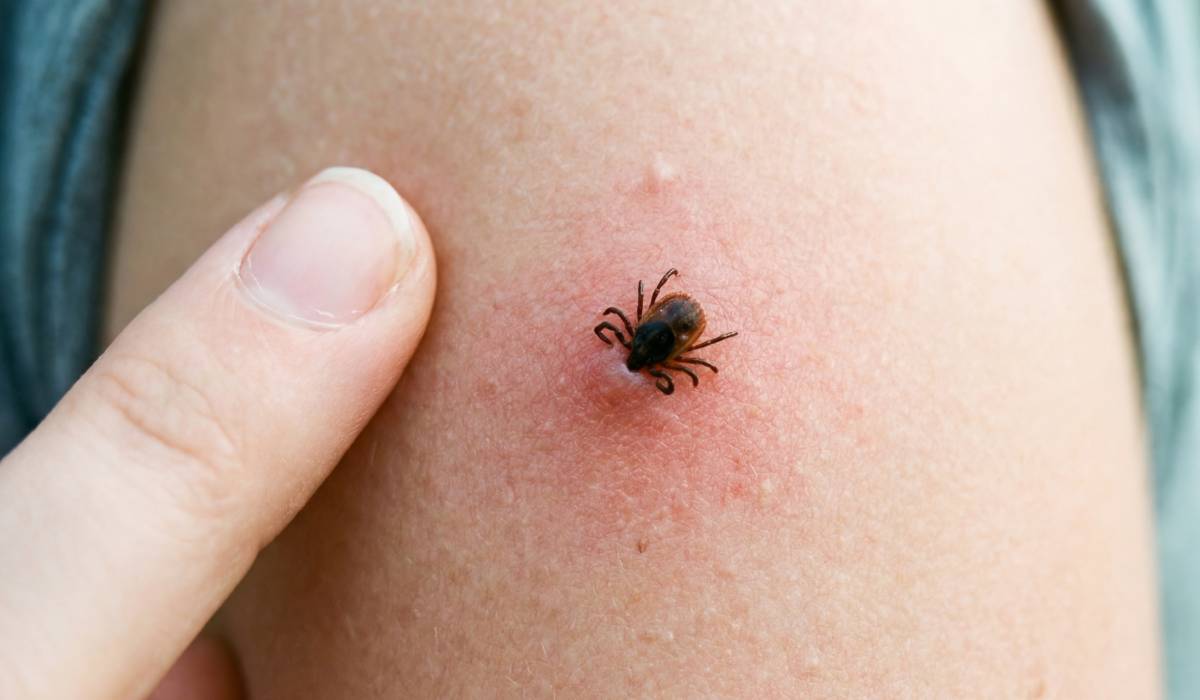 Mușcăturile de insecte, o problemă în creștere chiar și în România din cauza schimbărilor climatice Problemele cauzate de înțepăturile și mușcăturile de insecte nu mai sunt specifice doar călătoriilor în zone exotice