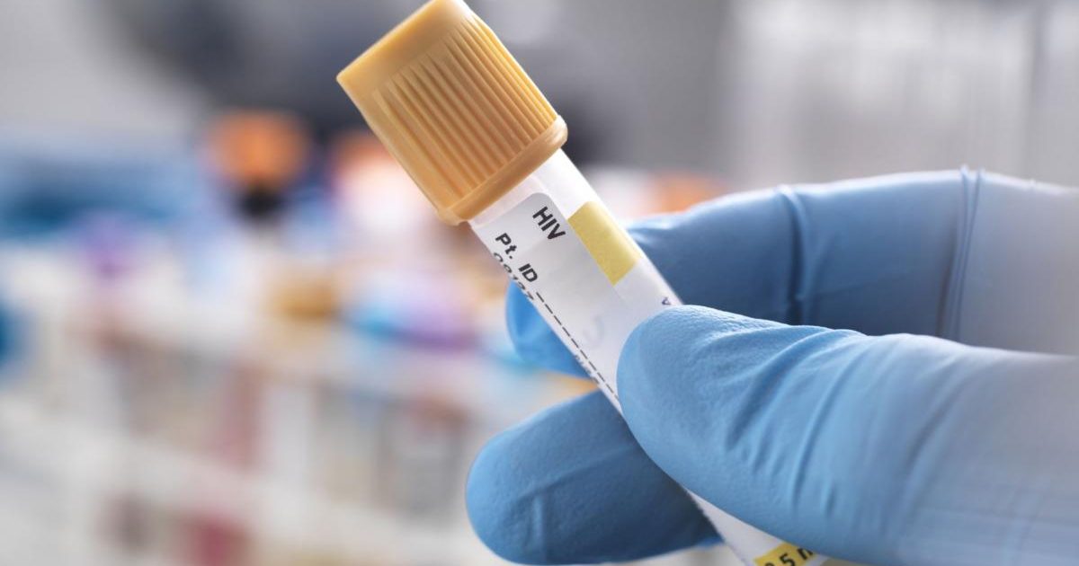 Bărbat vindecat de HIV după transplant de la frate: O premieră medicală