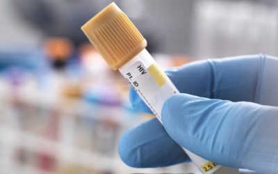 Bărbat vindecat de HIV după transplant de la frate: O premieră medicală