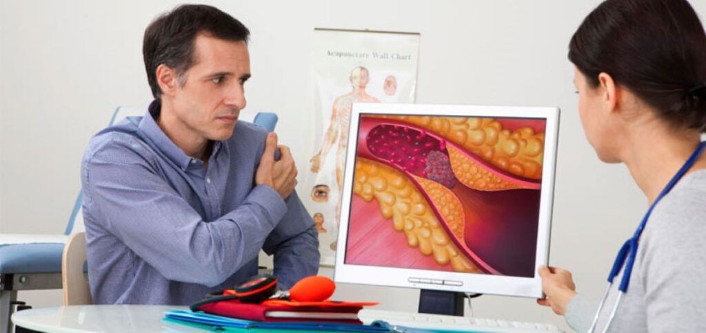 Nou: Cardiologii americani, avertisment dur despre colesterol și infarct