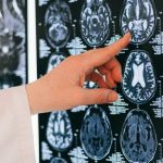 creier-radiografie-tesut-cerebral-rmn-tomograf-e1701797034546.jpg - NewsFactor