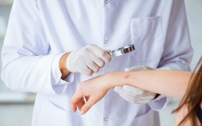 Afecțiune misterioasă: Cauze și tratamente eficiente