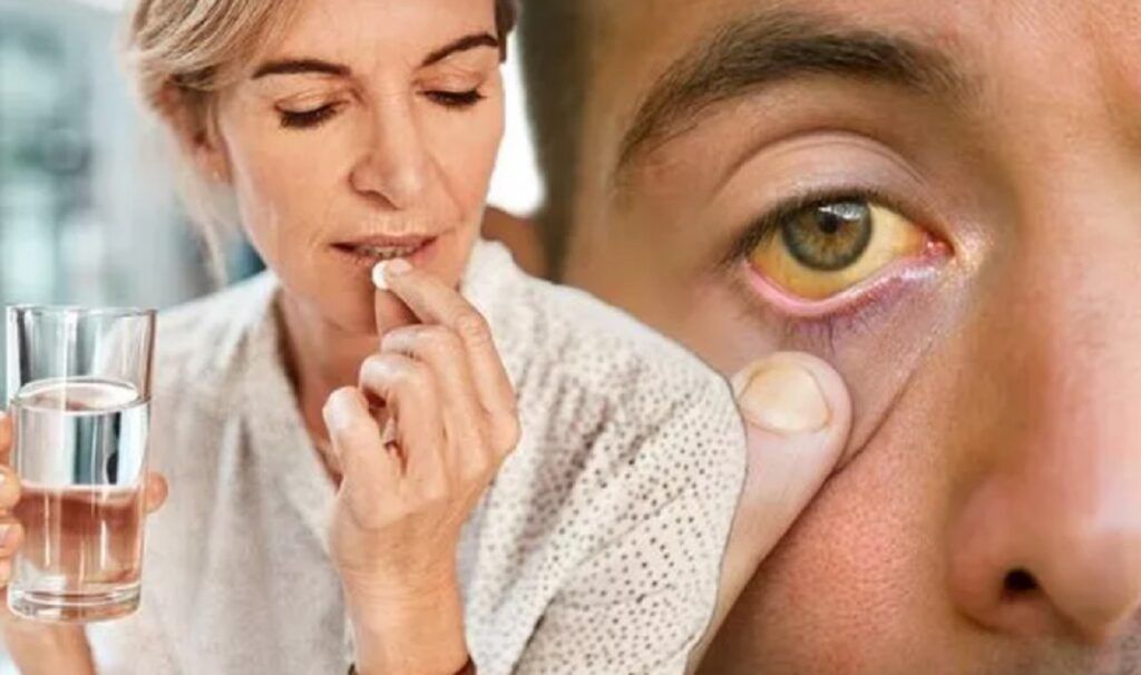 Aspirina zilnică: AVERTISMENTUL cardiologilor pentru milioane de oameni