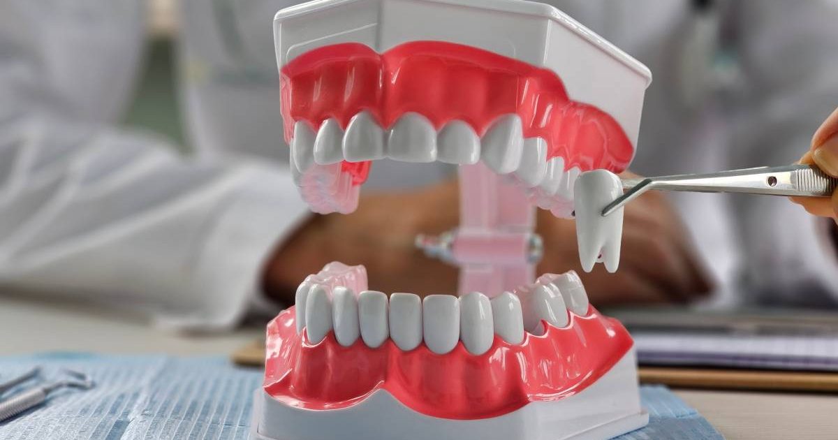 Extracție sau nu în ortodonție? Ce spun medicii și de ce contează
