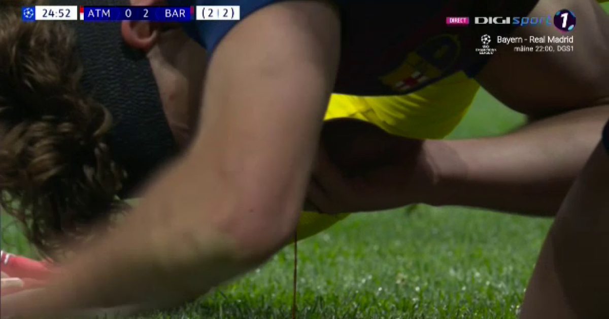 Accidentare GRAVĂ în Atletico-Barcelona: Fermin Lopez, plin de sânge pe teren