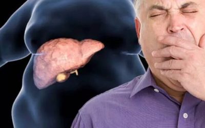 Boala ficatului gras, tratată fără dietă. Descoperirea șoc a cercetătorilor