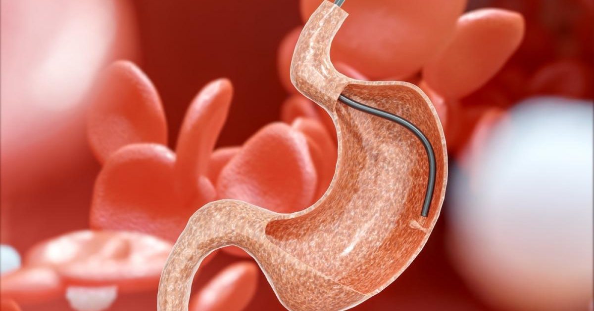 Ai probleme digestive persistente? Arsuri, balonare, dureri abdominale sau modificări ale tranzitului intestinal pot fi semne ale unor afecțiuni care necesită atenție medicală