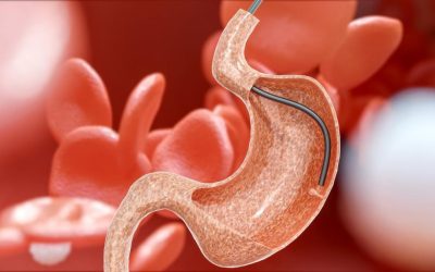 Ai probleme digestive persistente? Arsuri, balonare, dureri abdominale sau modificări ale tranzitului intestinal pot fi semne ale unor afecțiuni care necesită atenție medicală