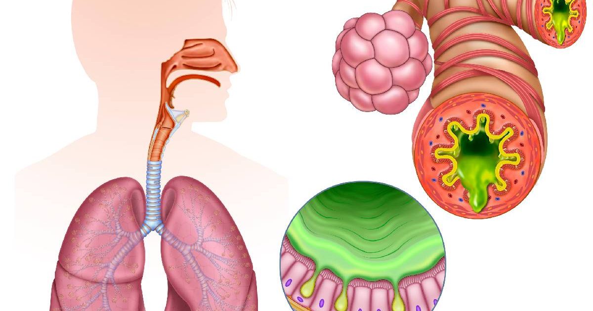 Dușmanul invizibil care ne distruge sănătatea: Pericolul ascuns