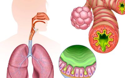 Dușmanul invizibil care ne distruge sănătatea: Pericolul ascuns