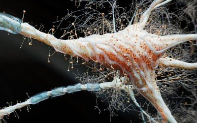 Inflamația intestinală, posibil factor cheie în scleroza multiplă