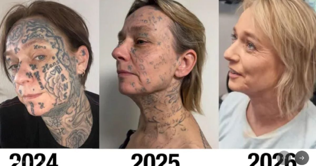Olandeză, Tatuată cu 250 de Nume: Fostul Iubit, Marcă Pe Viață