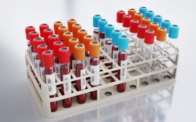 Analiză SÂNGELUI, mai precisă ca colesterolul: Riscul de infarct, detectat