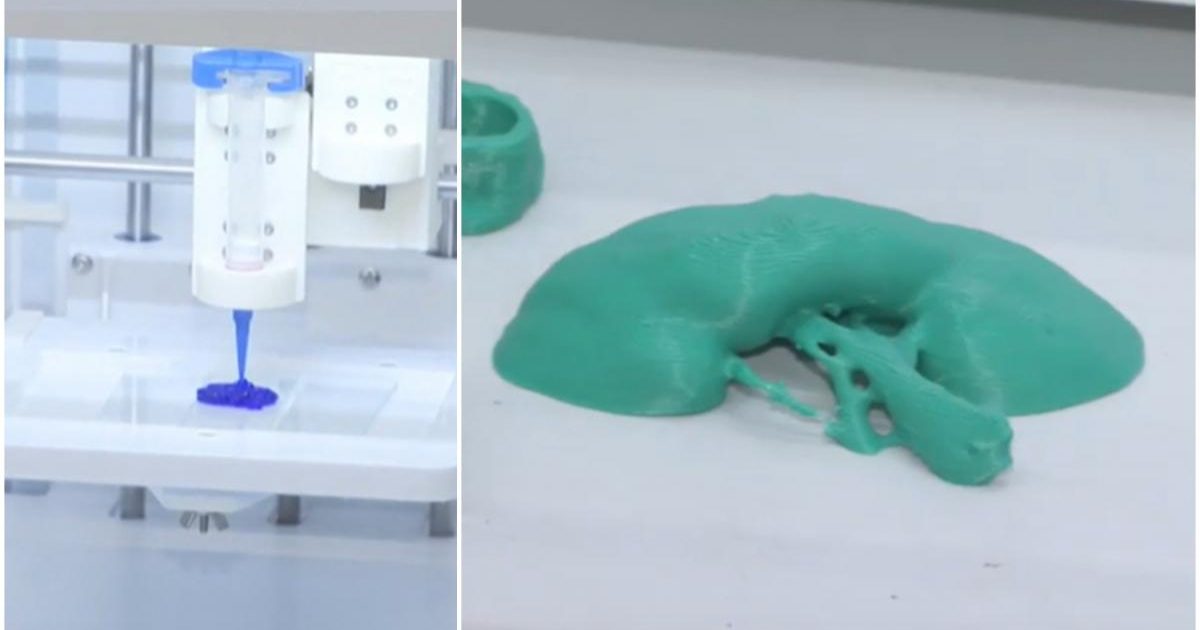 Rinichi „printat” la București: Cercetătorii din România pun medicina pe șine – detalii incredibile