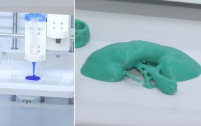 Rinichi „printat” la București: Cercetătorii din România pun medicina pe șine – detalii incredibile