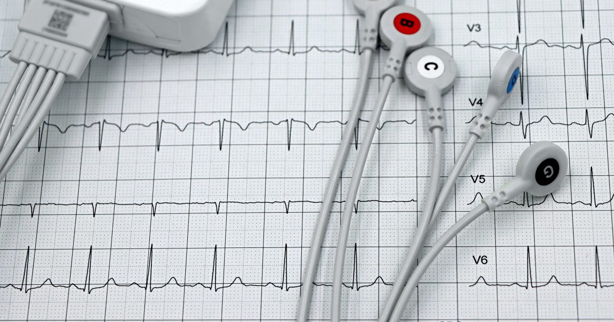 Comisia Europeană cere păreri: Screeningul cardiovascular, vital în UE, cu 1,7 milioane decese