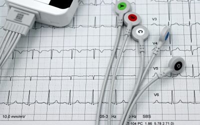 Comisia Europeană cere păreri: Screeningul cardiovascular, vital în UE, cu 1,7 milioane decese