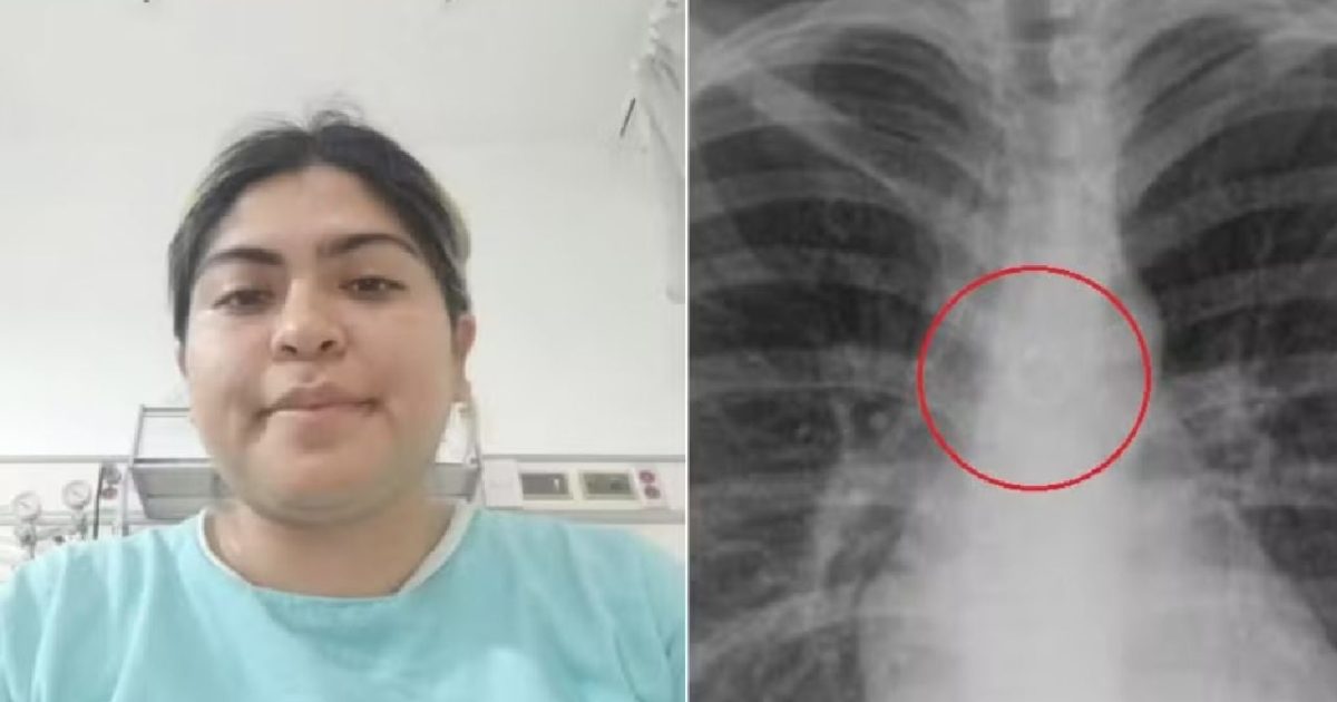 Tânără, de 26 de ani, cu piercing în plămâni, șoc la control în Mexic