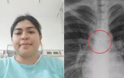 Tânără, de 26 de ani, cu piercing în plămâni, șoc la control în Mexic